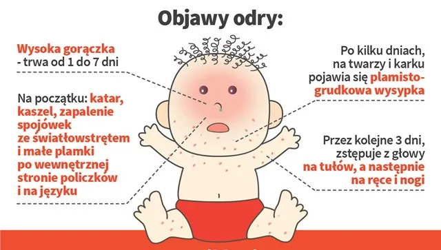 Od listopada już 45 zachorowań na odrę