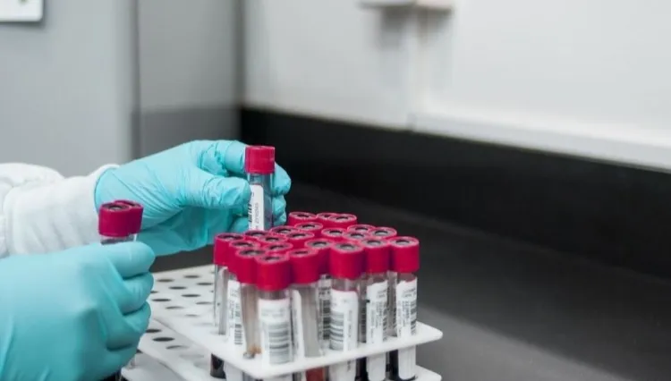 Wykaz laboratoriów SARS-CoV-2 [LISTA]