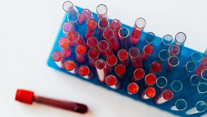 Są dane resortu zdrowia. Mamy 6496 nowych zakażeń koronawirusem. Zmarły 444 osoby