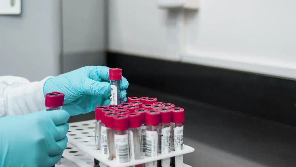 Pierwszy na świecie przypadek ptasiej grypy H3N8 u człowieka