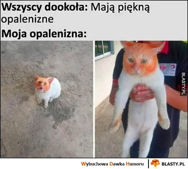 Opalenizna