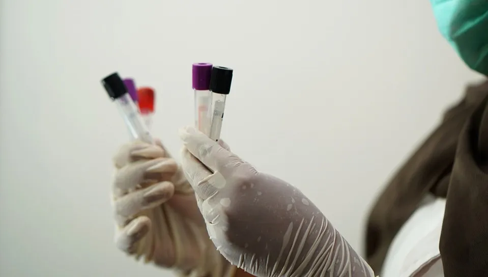 W Polsce potwierdzono dotąd 104 przypadki małpiej ospy