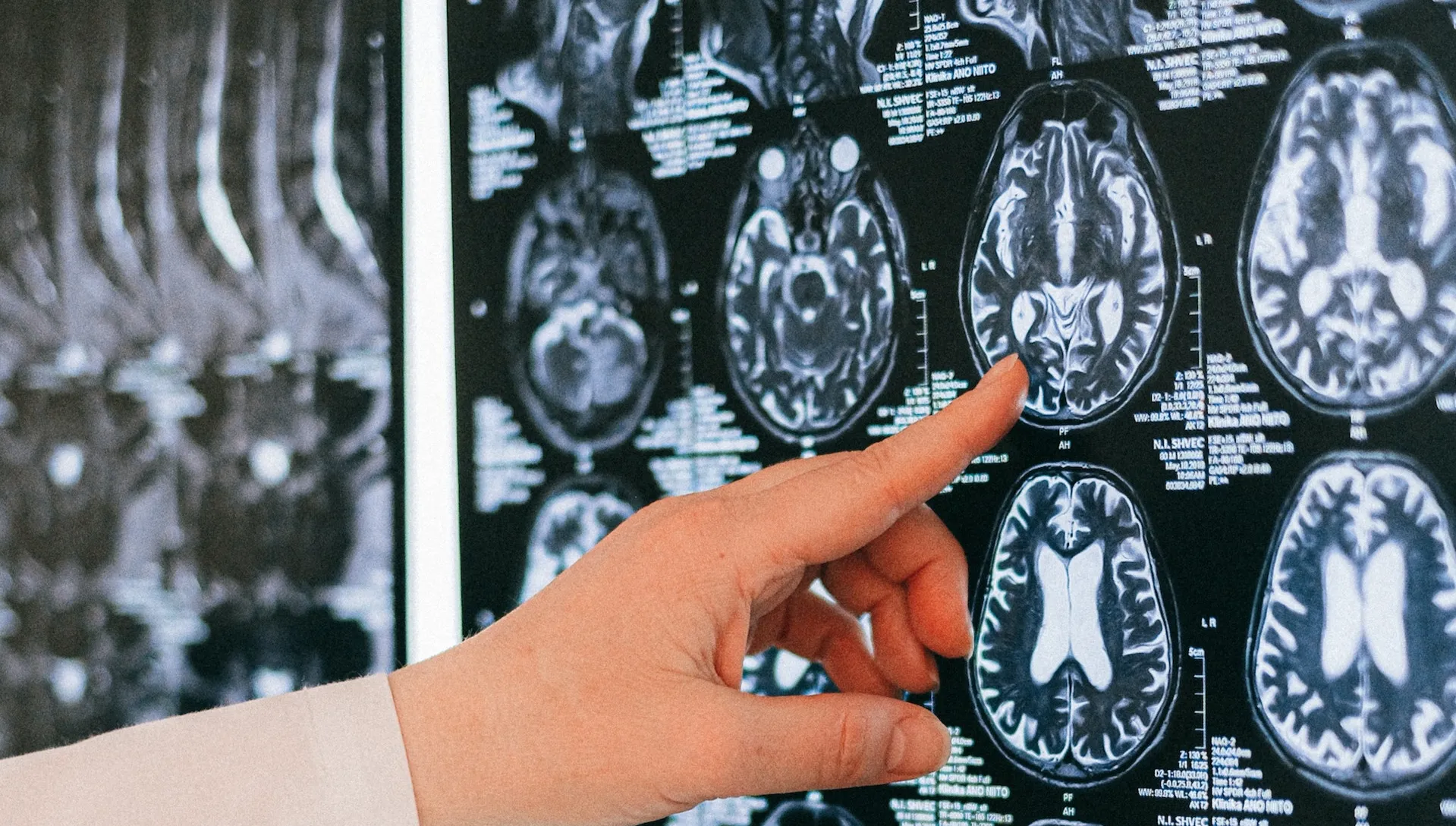 Zaskakujący efekt pandemii. Mózgi nastolatków starsze o całe lata? 