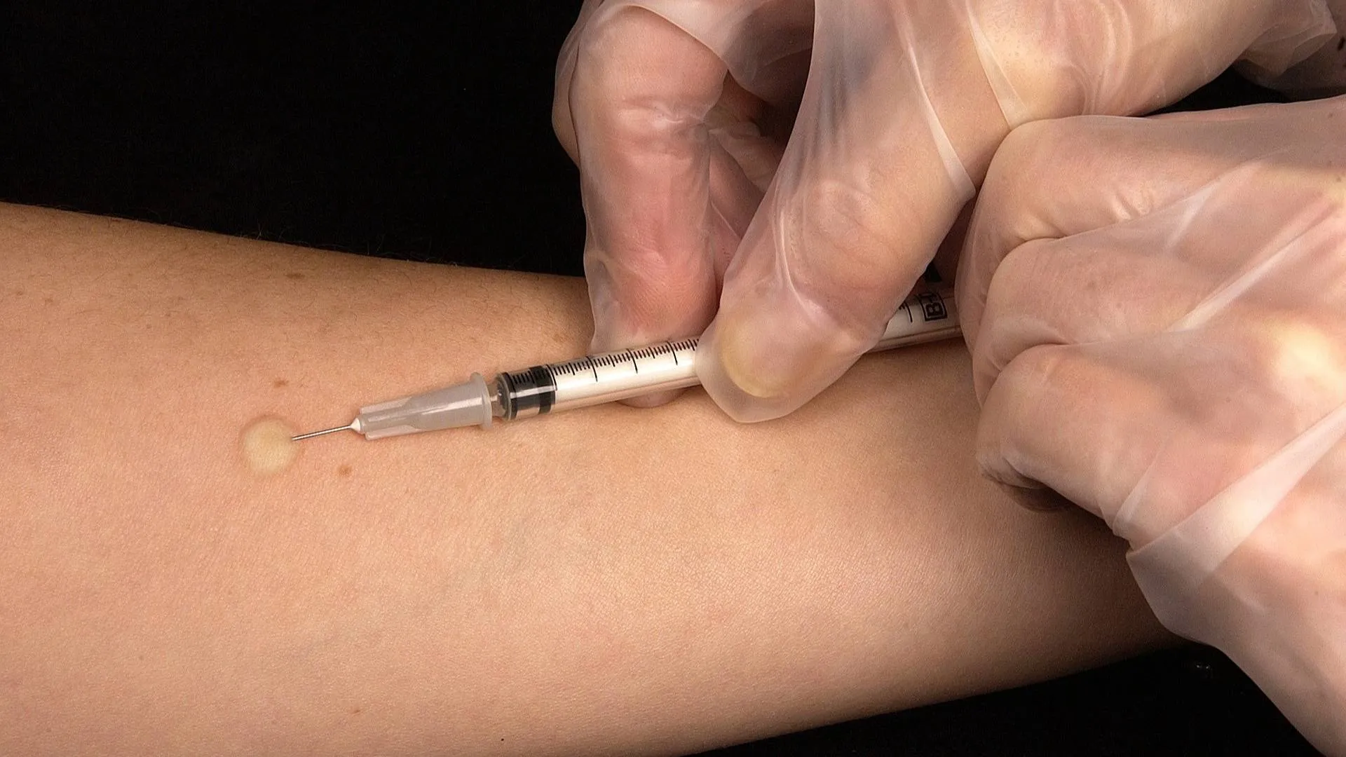 Refundowane szczepienia przeciw HPV ruszą niebawem