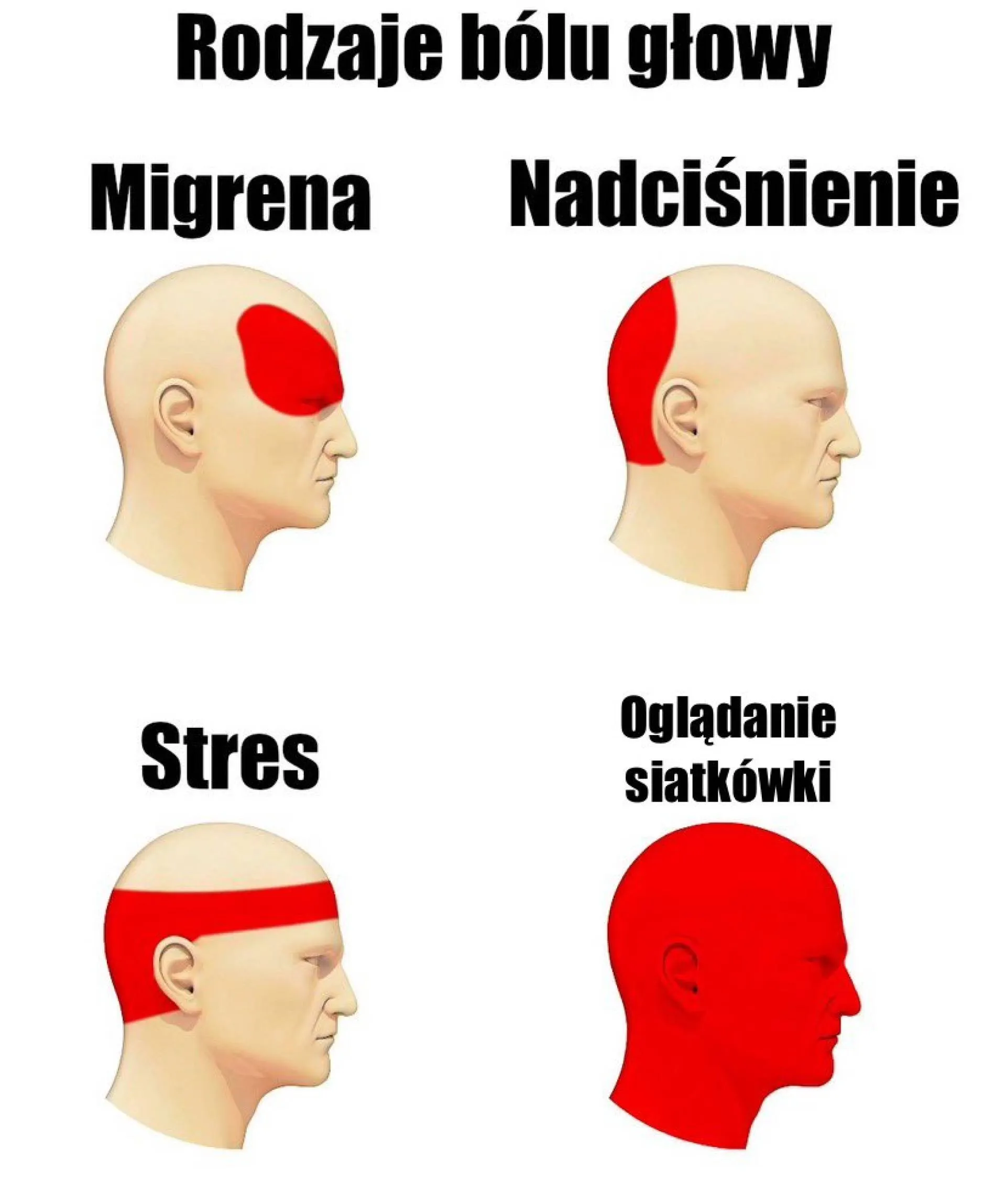 Ból głowy