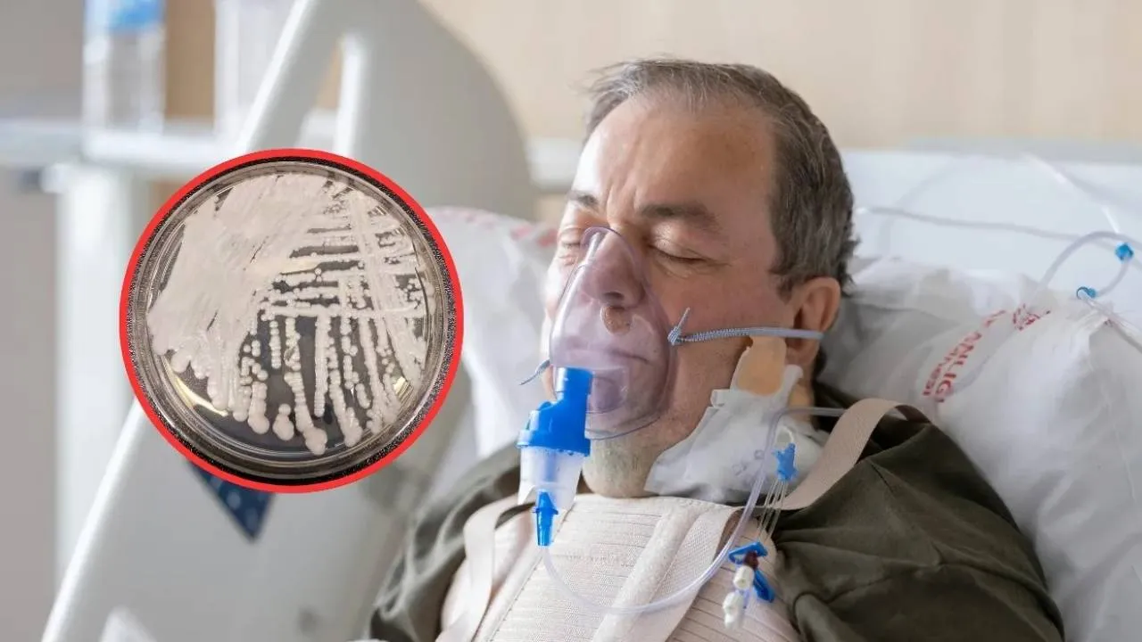 Superpatogen odporny na leki rozprzestrzenia się w USA. "Organizm zdany sam na siebie"